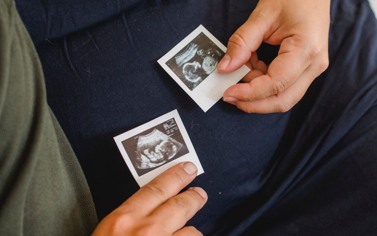 Morte de feto em acidente dá direito a seguro obrigatório DPVAT