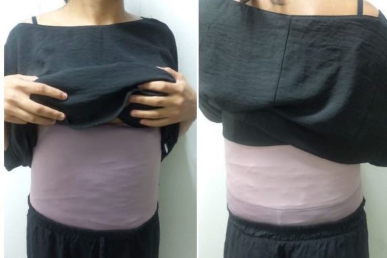 Justiça aumenta pena de mulher que foi flagranteada com drogas escondidas no corpo
