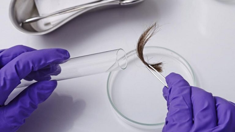 Laboratório é condenado a indenizar mulher por falha na coleta de cabelo