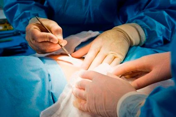 parto_cirurgia
