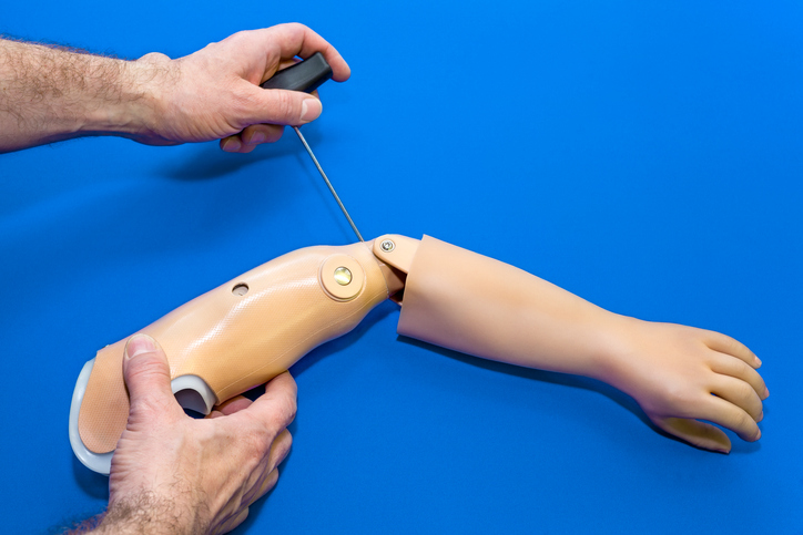 Montador que perdeu a mão em acidente de trabalho receberá prótese, pensão e indenização