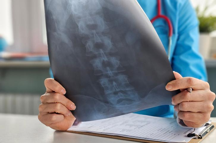 TST reconhece direito à estabilidade a trabalhador que teve doença ocupacional constatada após dispensa