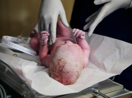 Conduta médica inadequada: TJSP reconhece falha em parto e mantém dever de indenizar