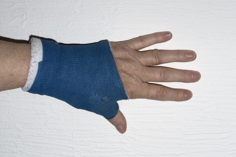 Idosa que caiu ao tropeçar em quiosque inflável deve ser indenizada