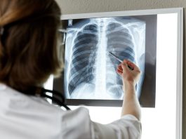 Indústria é condenada a indenizar viúva e filhos de trabalhador que morreu de fibrose pulmonar