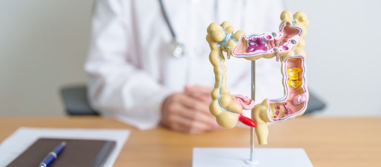 Fábrica de alimentos é condenada por dispensar operador com doença de Crohn
